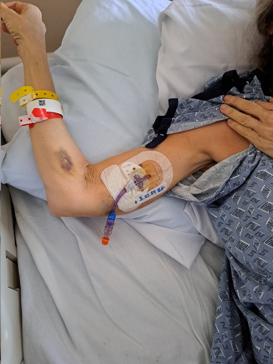 ForbiddenLeaf's tweet photo. The first time that I fought cancer I was 30yrs old, my boys were 5, 3 &amp; 2yrs old.
Unfortunately 30 years later the cancer has come back, my first hospital visit was for 2 weeks and my husband never left my side, I wouldn't have made it without him ❤️ https://t.co/eK3dda44Qc