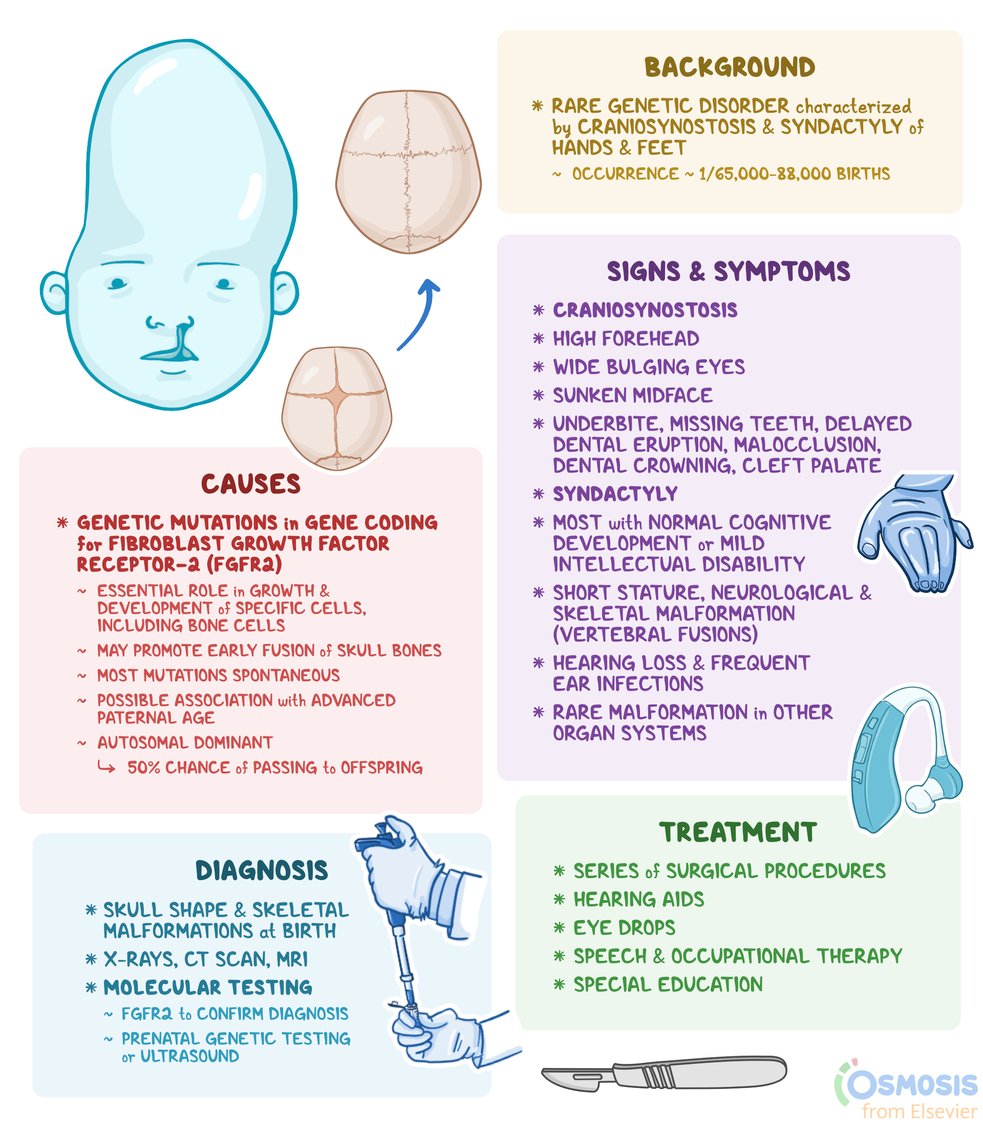 @IhabFathiSulima #MedTwitter #MedX #MedEd
APERT SYNDROME WITH FUSION OF DIGITS 
May have craniosynostosis, midface hypoplasia &symmetric syndactyly of the hands and feet. craniosynostosis is more severe & additional finding of syndactyly helps confirm diagnosis between multiple, similar syndromes…