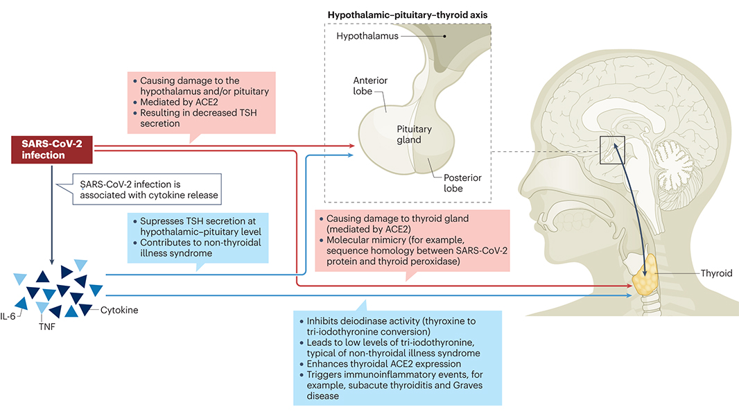 COVID-19 has been linked to an increase in thyroid dysfunction among current and past patients. A Review in @NatureRevEndo discusses and evaluates the evidence for COVID-19 causing thyroid dysfunction, including during long COVID. go.nature.com/4a0mdoC