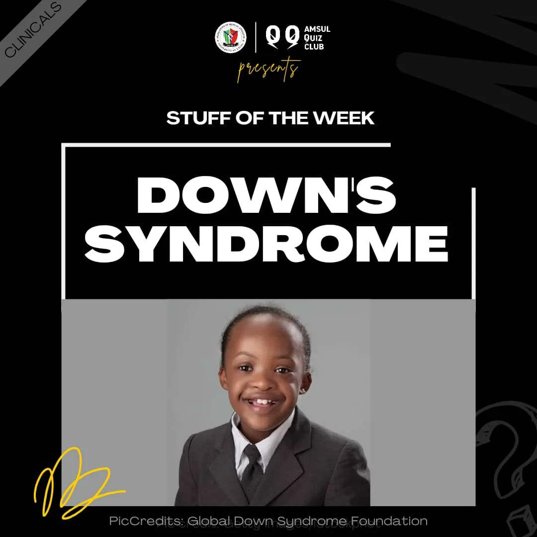 amsulquizclub's tweet photo. On today's edition of our 'Stuff of the Week', we bring you information about... 🤓
Topic: Down's Syndrome 🩺
Dive in and read up all we have for you in our post!
Tell us one new thing you've learnt in the comments as well! 🧠
#stuffoftheweek #clinicals https://t.co/7PagJabeBL