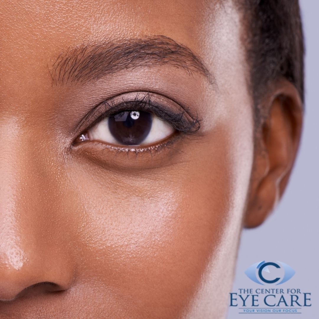 Eyes are the windows to the soul, so take care of them with regular eye care appointments at The Center for Eye Care. Your vision matters! #eyedoctor #eyehealth #eyecareplan