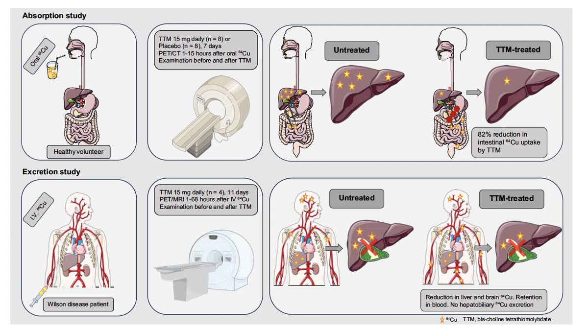 1/ 🚀 JHEP Journal Club🚀

Novel Insights into the Mechanism of Action of the Copper Chelator Bis-Choline Tetrathiomolybdate (TTM) in Wilson's Disease (WD)‼️
🔓pubmed.ncbi.nlm.nih.gov/38081365/

🫤Wilson👉 Cu2+ load in liver &amp; brain

Frederik Teicher Kirk &amp; cols 🔎 TTM👇👇
@livertwitter