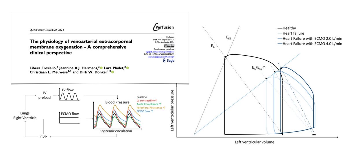 The physiology of VA #ECMO, comprehensive clinical perspective: 🩸basic hemodynamic alterations explained 🫀cardiac function & loading Open access #FOAMcc #FOAMecmo 🔓 bit.ly/4bdeHb5 #ELSO2024 Perfusion special issue 🔓 journals.sagepub.com/toc/prfa/39/1_…