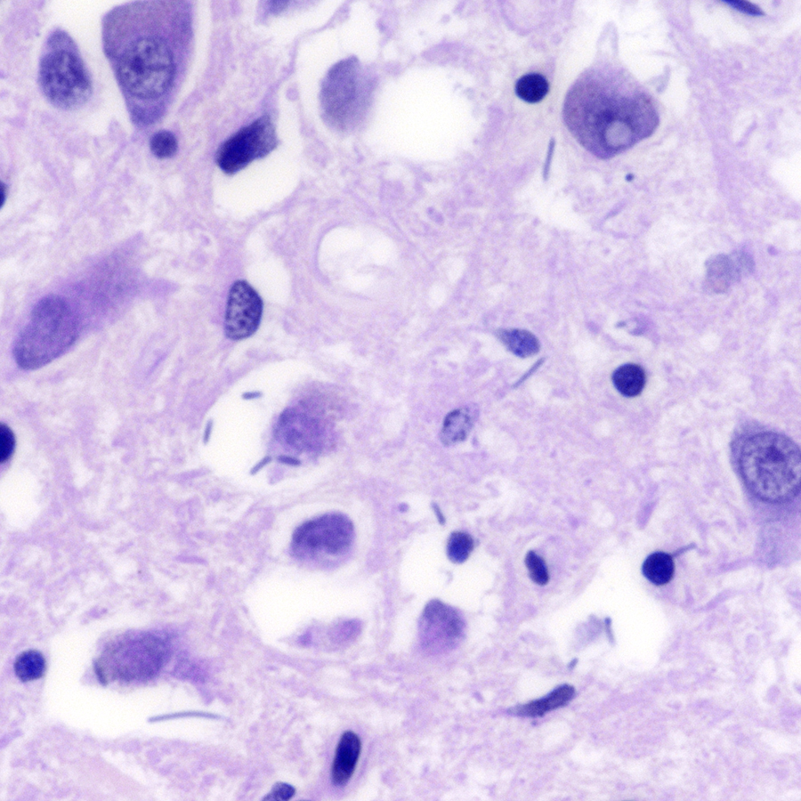 What's abnormal about this high power view of the pons? Is this premortem or postmortem? How can you tell? #pathology #neuropath #pathtwitter