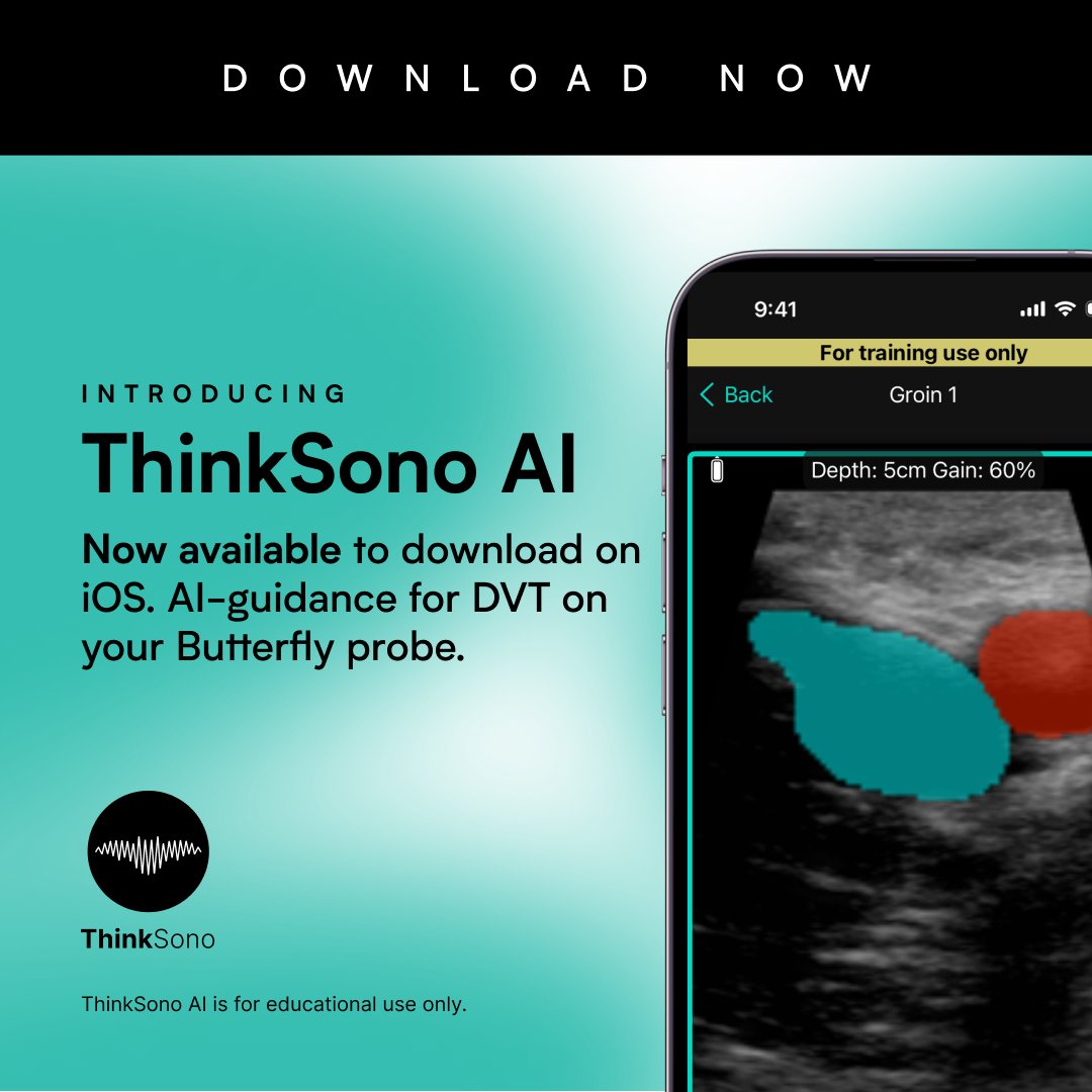 ThinkSono recently released the new ThinkSono AI app, which brings real-time AI guidance for DVT to Butterfly devices across the globe. As a special offer, all Butterfly customers can access ThinkSono AIwith a 30-day free trial. Check it out HERE: butterflynetwork.com/ai-marketplace