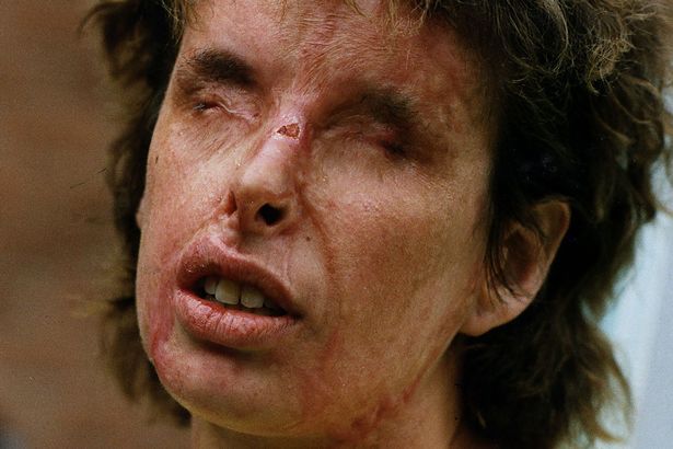 Dale Yeager: Restriction on Guns and Knives Increase Acid Attacks In Britain By 70% buff.ly/414hDBv #uk #daleyeager #travelsafety