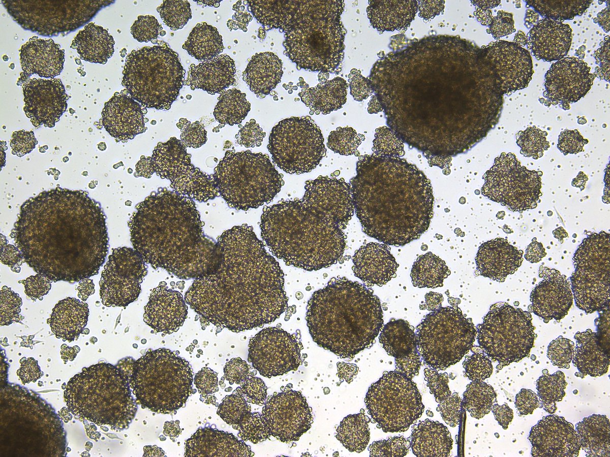 In my lab at the <a href="/prinsesmaximac/">PrinsesMáximaCentrum</a>,  Princess Máxima Center  for pediatric oncology (in Utrecht NL), we're looking for a great postdoc to focus on immunotherapy and organoid technology. For more info, check: werkenbijprinsesmaximacentrum.nl/vacature/postd…