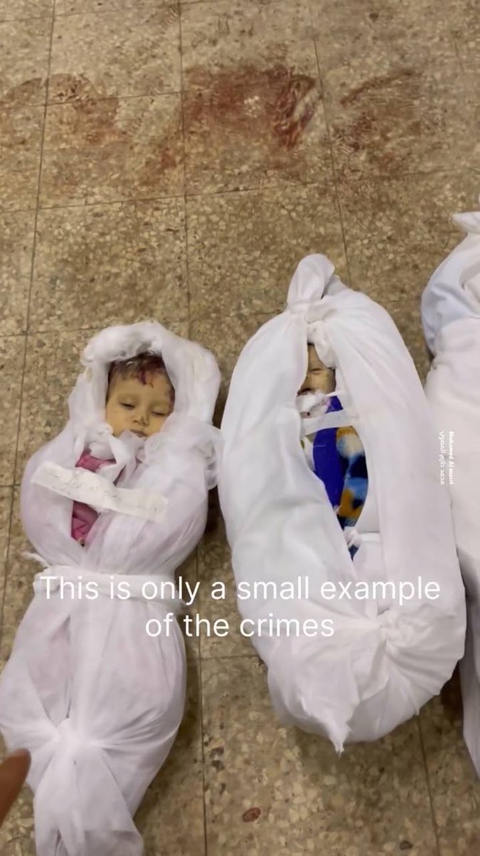 BABIES ARE BEING SLAUGHTERED BY ISRAEL

*NSFW