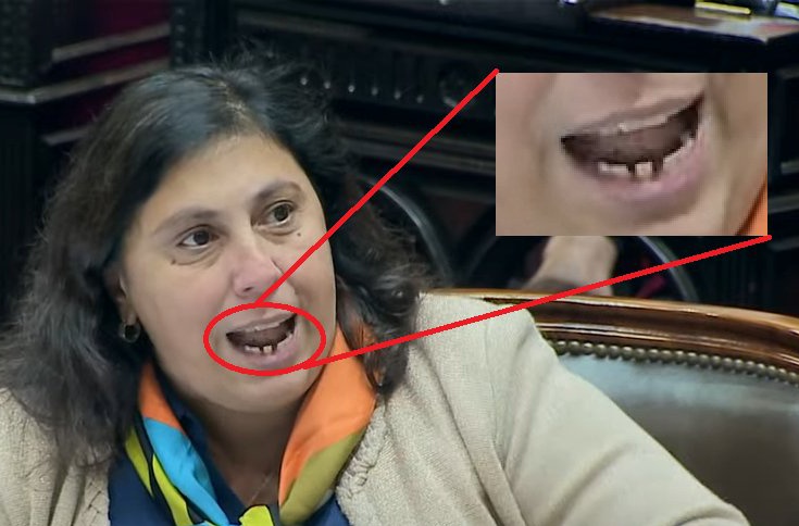 La zurda con mejor dentadura: