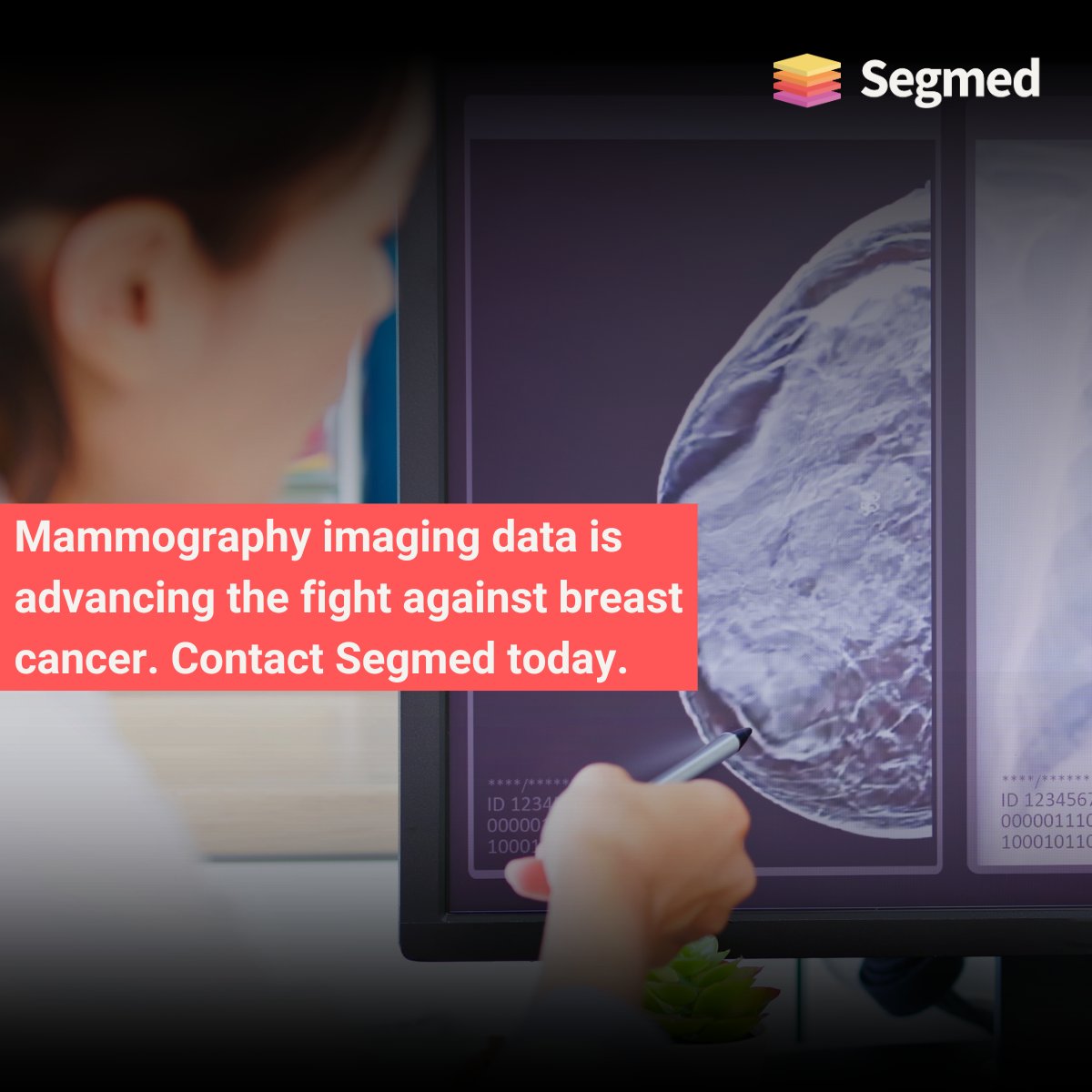 🔍 Using Imaging data to make late-stage breast cancer a rarity.

Join our global network of healthcare partners and put your medical imaging data to good use. Learn more about partnering with Segmed at hubs.li/Q02vpH0N0

#AIinHealthcare #RealWorldData