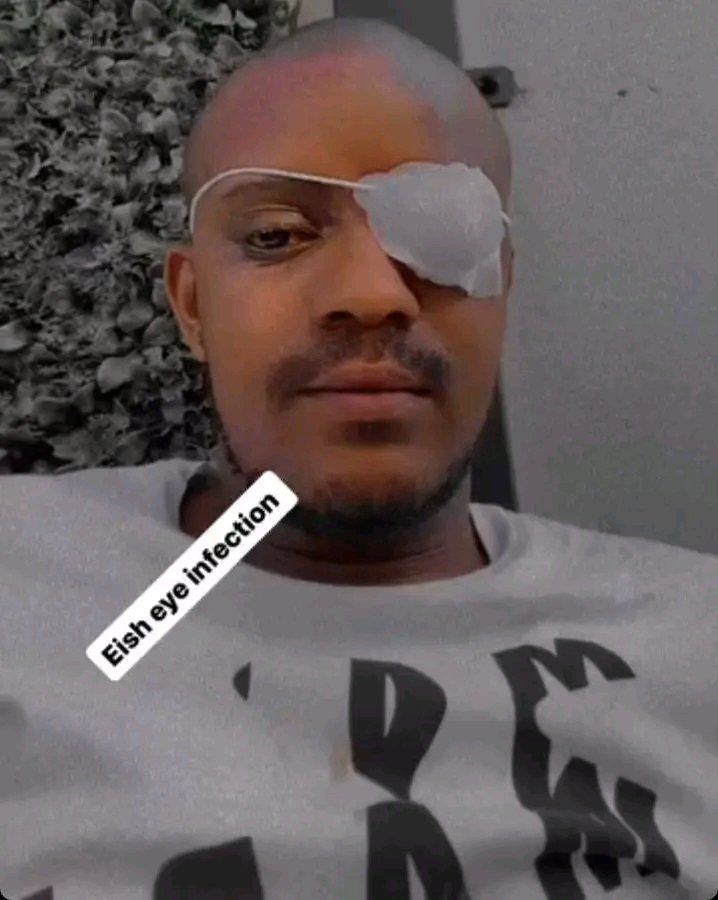 Kabza De Small got an eye infection 🥴