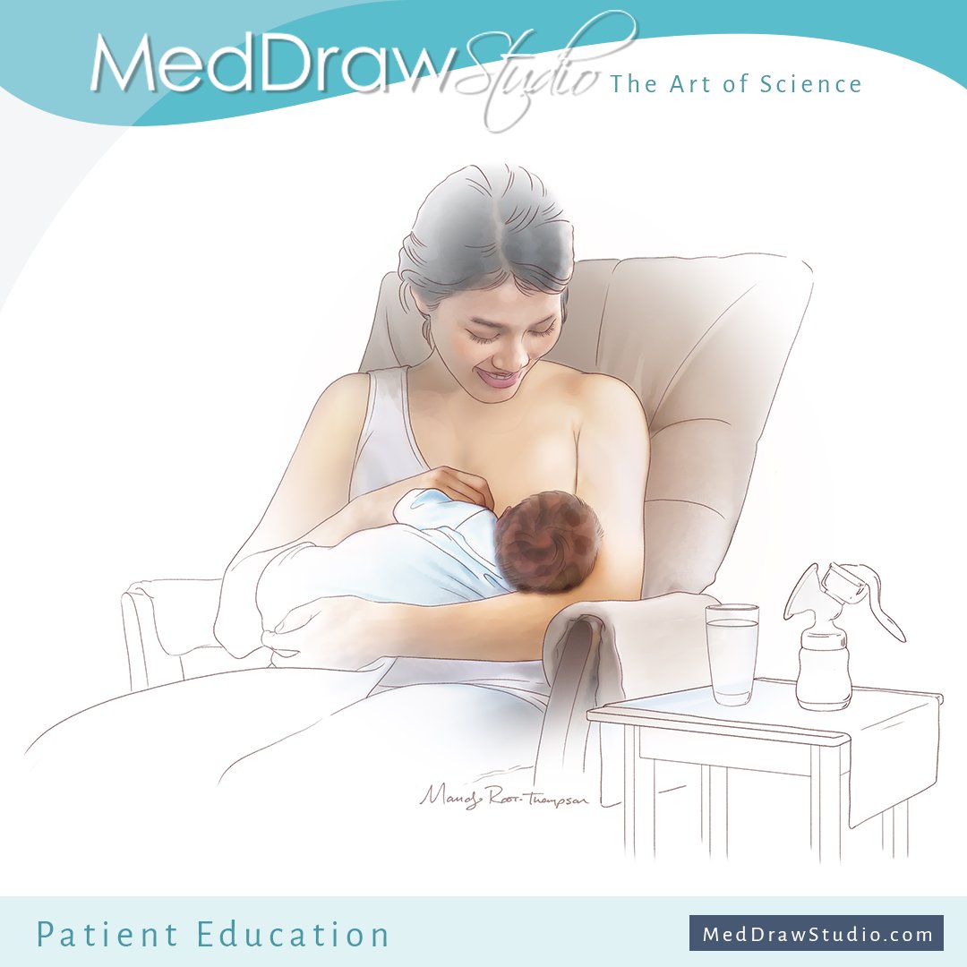 This patient education illustration highlights the importance of breastfeeding in the early stages of life. 

#PatientEducation #Breastfeeding #TheArtofScience #MedicalIllustration @medical-illustration-&-animation @association-of-medical-illustrators  @baby-gooroo