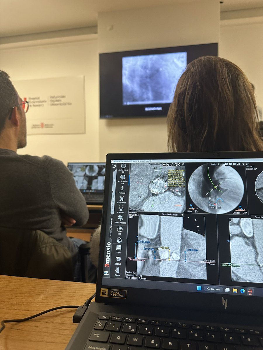 Excelente taller impartido por el equipo de Hemodinámica del HUN sobre planificación de TAVI. <a href="/RamallalRaul/">Raul Ramallal</a> <a href="/vruizquevedo/">Valeriano</a> <a href="/HemodinamicaC/">HemodinamicaHUN</a> #3Mensio #TAVI