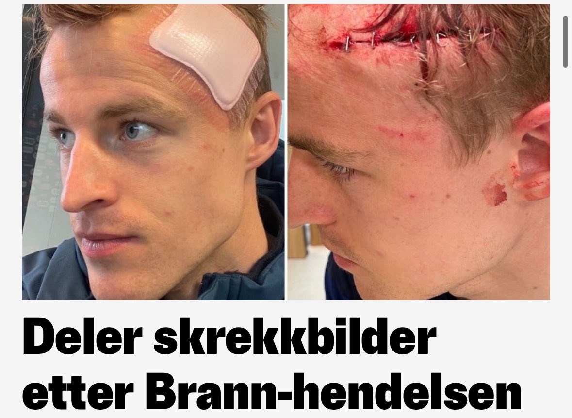 Edvartsen's tweet photo. Tenk at noen i går hevdet at Finne ikke utsatte målvakten for fare….. https://t.co/iuyhyrvxW7