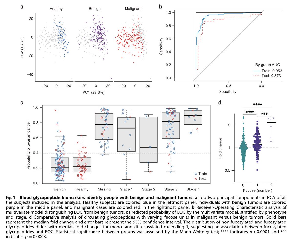 apoorvasriniva's tweet photo. our work in diagnosing and staging ovarian cancer with blood samples, led by chirag dhar is now published!   
https://t.co/qtjYZRdnS6

- we find a panel of glycoproteomic biomarkers that can distinguish between benign and malignant ovarian cancer with high accuracy and  
- we show that fucosylation is associated with late-stage ovarian cancer suggesting it as a promising target for targeted therapy.   

exciting times for the field of glycoproteomics!
