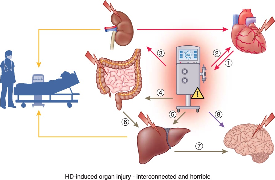 Patients requiring hemodialysis have a higher risk of cardiovascular morbidity & mortality. This Review examines the pathophysiology of hemodialysis-related vascular injury & consider a range of therapeutic approaches to improving outcomes bit.ly/JASN0299