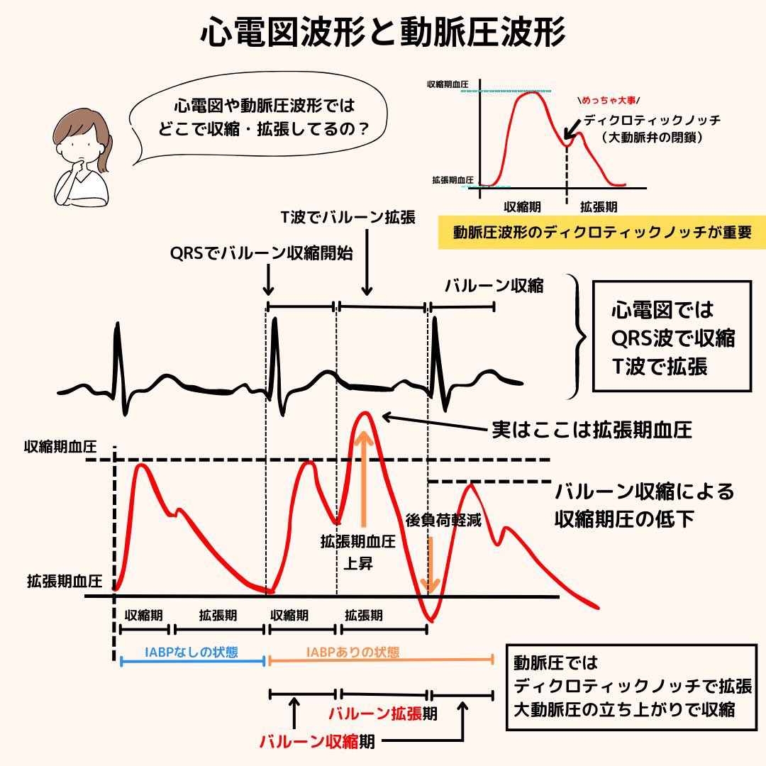 @spica_aoitori 自己の圧が抜去後の自己の血圧の指標になるかという表現はよくわかりませんが、添付した資料で説明できるでしょうか？
自己の圧、オーグ圧は先端のセンサーで測定したものと考えてもらえれば大丈夫です。
資料の波形ではIABPの影響で心臓の拡張期の圧が収縮期よりも高いことがわかると思います。
