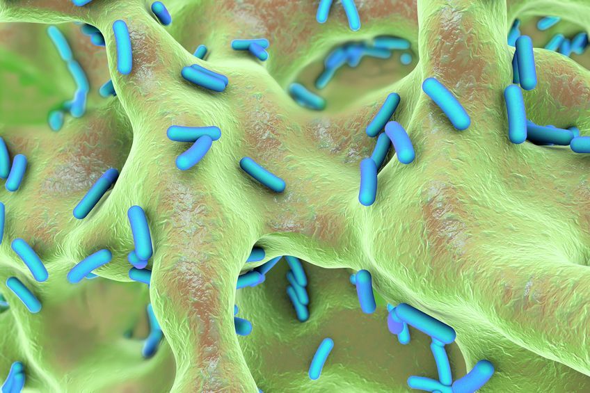 Predicting Infection in Lupus Nephritis Machine learning (ML) models were applied to 3 cohorts of lupus nephritis (LN) patients and established algorithms to predict co-infection in LN. buff.ly/3QnErcy