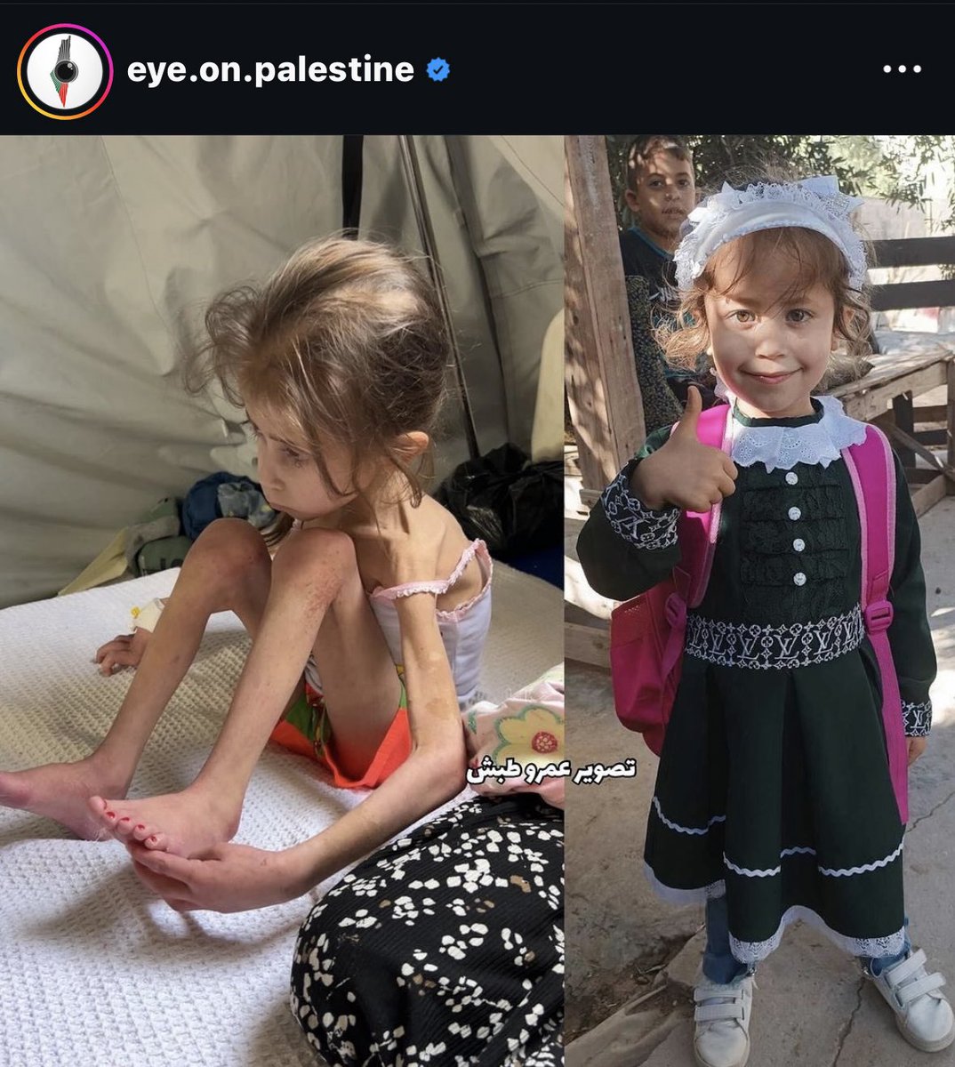 This is Jana Ayyad. Don’t look away. Israel is starving her as well as other children in Gaza.