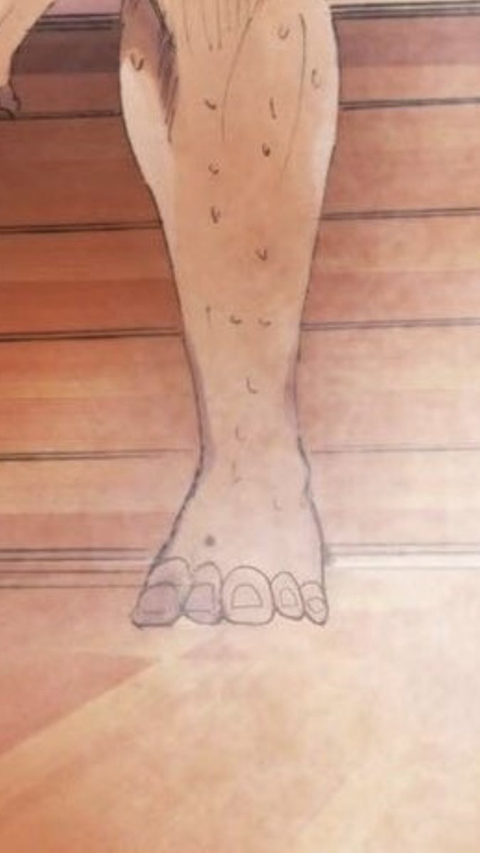 Why does reiner have like 3 big toes