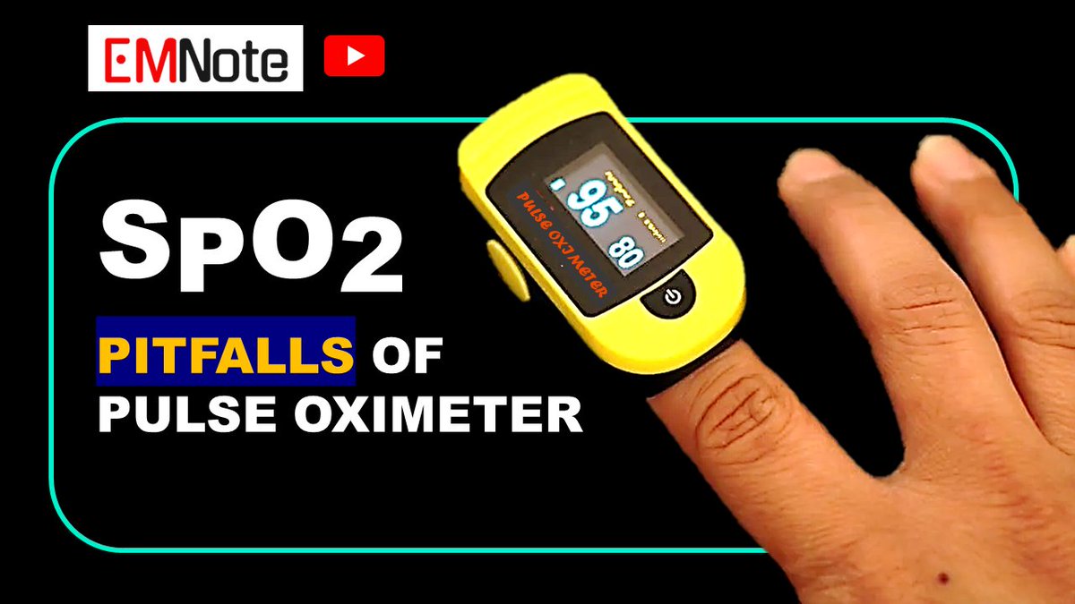 Pulse Oximetry Pitfalls. youtu.be/cyjjnv_2gDY&li… Potential pitfalls of SpO2 include interference from abnormal HB species, inaccuracies at extremes of HB level, the inability to detect hypoxemia in certain conditions, and the effects of poor perfusion or motion artifacts.