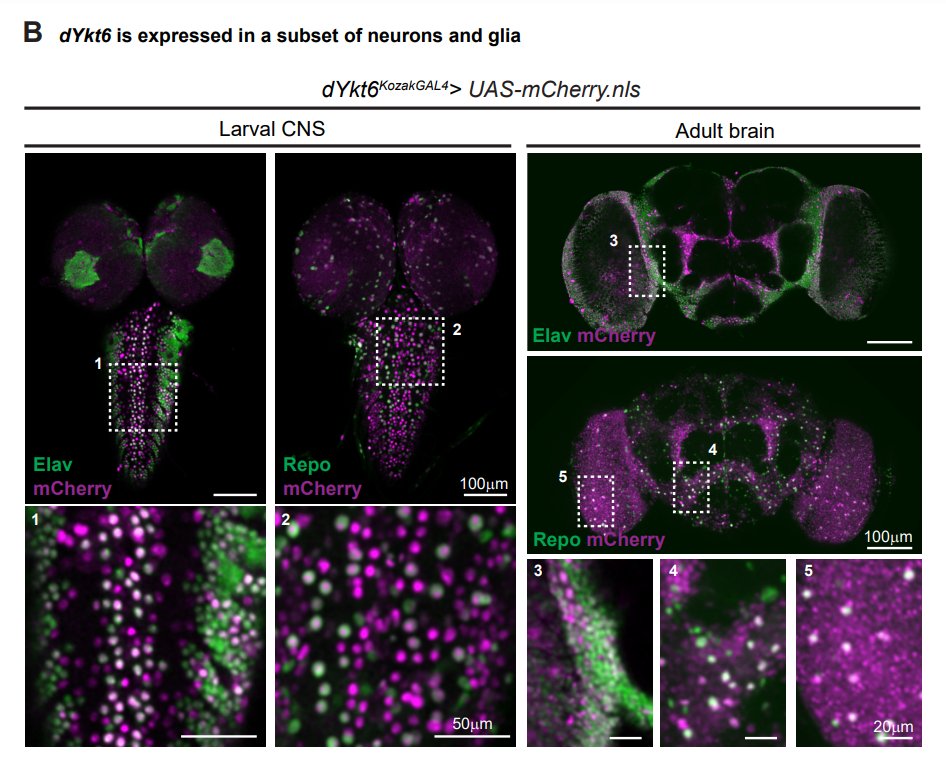 A new neurohepatopathy? Homozygous loss-of-function YKT6 variants cause neurodevelopmental delay with or without severe infantile liver disease bit.ly/49Xtq90