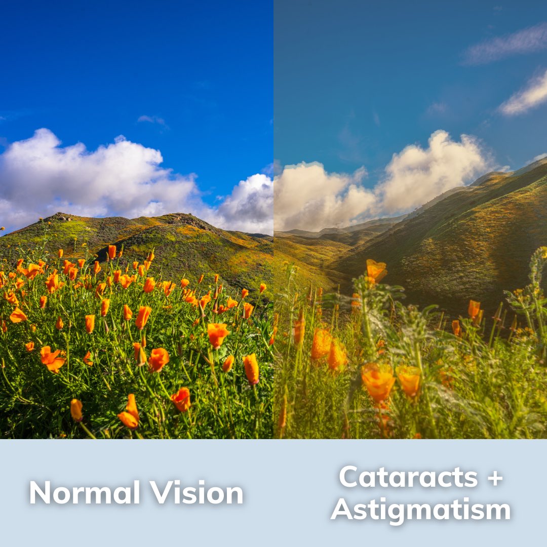 Don’t let cataracts and astigmatism cloud your view of the world. Take charge of your eye health by getting your annual eye exam and discover a clearer, sharper perspective. To learn more about personalized laser cataract surgery call > 847.356.0700