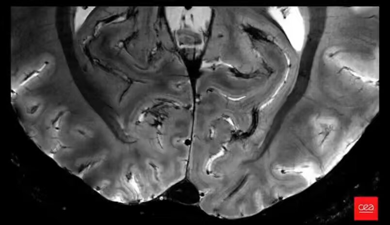 You are #UHF #MRI enthusiastic and will be at #ISMRM2024 ? Get ready for the disclosure of the first in vivo brain MRI at 11.7T with #Iseult magnet. Will happen on Tuesday at 13:30 during session Ultra-Challenging Ultra-High Field Applications. @CEA @NeuroSpin_91 @aroma_project