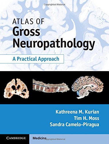 Atlas of Gross Neuropathology : A Practical Approach 1st Edition Ebook PDF #diagnosticpathology #Neuropathology

medicalebooks.org/atlas-of-gross…