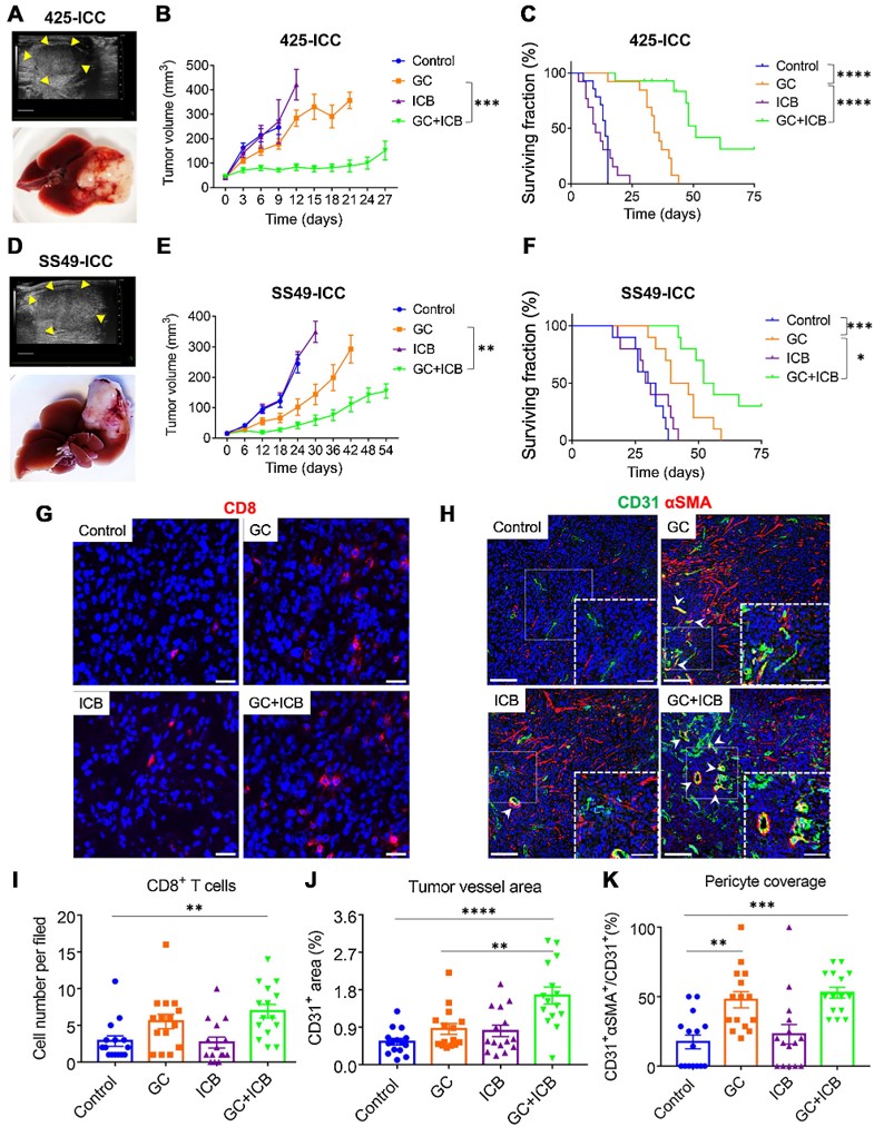 New Priority Brief from the April issue— Reprogramming the Intrahepatic Cholangiocarcinoma Immune Microenvironment by #Chemotherapy and CTLA-4 Blockade Enhances Anti–PD-1 Therapy, by Jiang Chen et al. bit.ly/3UCPGjU @MGHMedicine