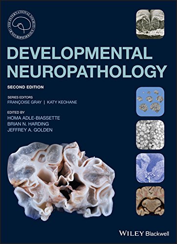 Developmental Neuropathology (International Society of Neuropathology Series) 2nd Edition Ebook PDF #Neuropathology

medicalebooks.org/developmental-…