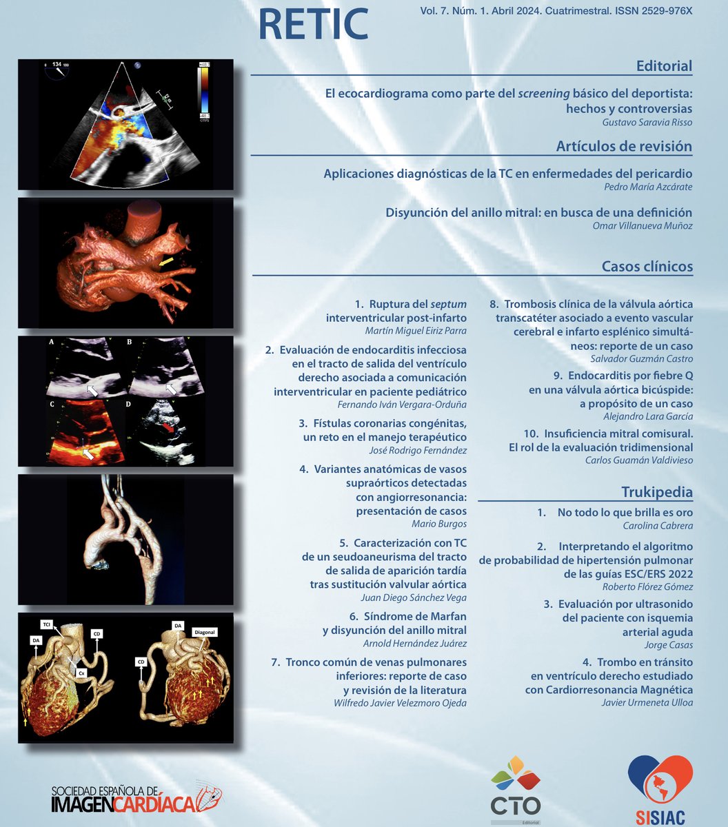 Ya tenemos nuevo número de nuestra revista. 👍👍 Gracias a todos los que hacéis esto posible!! @josejgdnews @MAecocardio @javierurmeneta1 @CardioCecconi @Azcarate_Cardio @almasthela @mariovar55 @CarlosfrancoEco imagenretic.org/RevEcocarPract