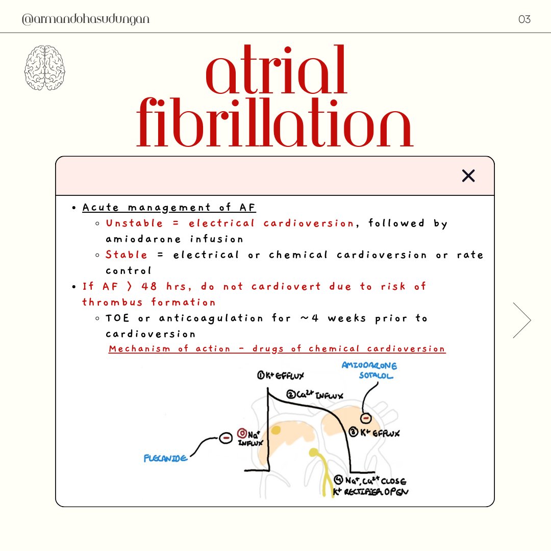 Atrial fibrillation (AF) is the most popular arrhythmia and diagnosed by the finding of an irregularly irregular ventricular rhythm without discrete P waves.

Watch the full video here: youtu.be/wxJuP-i9Jx0?fe…
.
.
.
#Armando #atrialfibrillation #af #heart #ECG