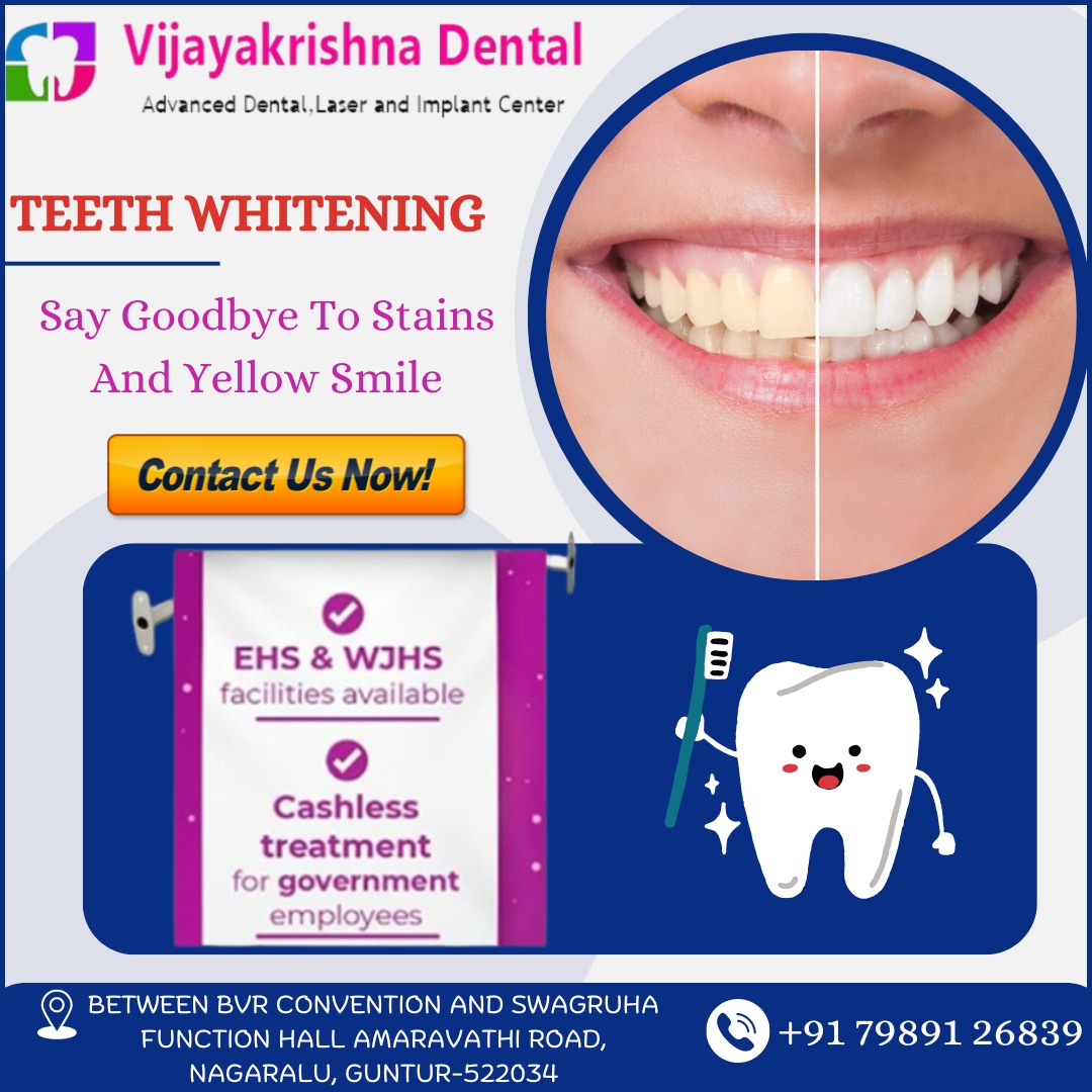 Teeth Whitening 
𝐅𝐨𝐫 𝐦𝐨𝐫𝐞 𝐢𝐧𝐟𝐨,
𝐕𝐢𝐬𝐢𝐭 𝐔𝐬: 𝐡𝐭𝐭𝐩𝐬://𝐯𝐢𝐣𝐚𝐲𝐚𝐤𝐫𝐢𝐬𝐡𝐧𝐚𝐝𝐞𝐧𝐭𝐚𝐥.𝐜𝐨𝐦
𝐂𝐚𝐥𝐥 𝐔𝐬 : +𝟗𝟏 – 𝟕𝟗𝟖𝟗𝟏 𝟐𝟔𝟖𝟑9
 #wisdomteeth #teethpain #wisdomteethremoval #ehs &wjhs #bestdoctors #vijayakrishnadental