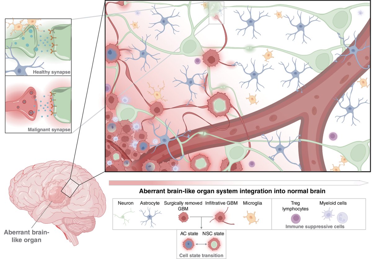 Read a Special Commentary from the April issue— #Glioblastoma: Not Just Another Cancer, by Howard Fine. bit.ly/3Uf6kF0 @WeillCornell @WCMCNeurology