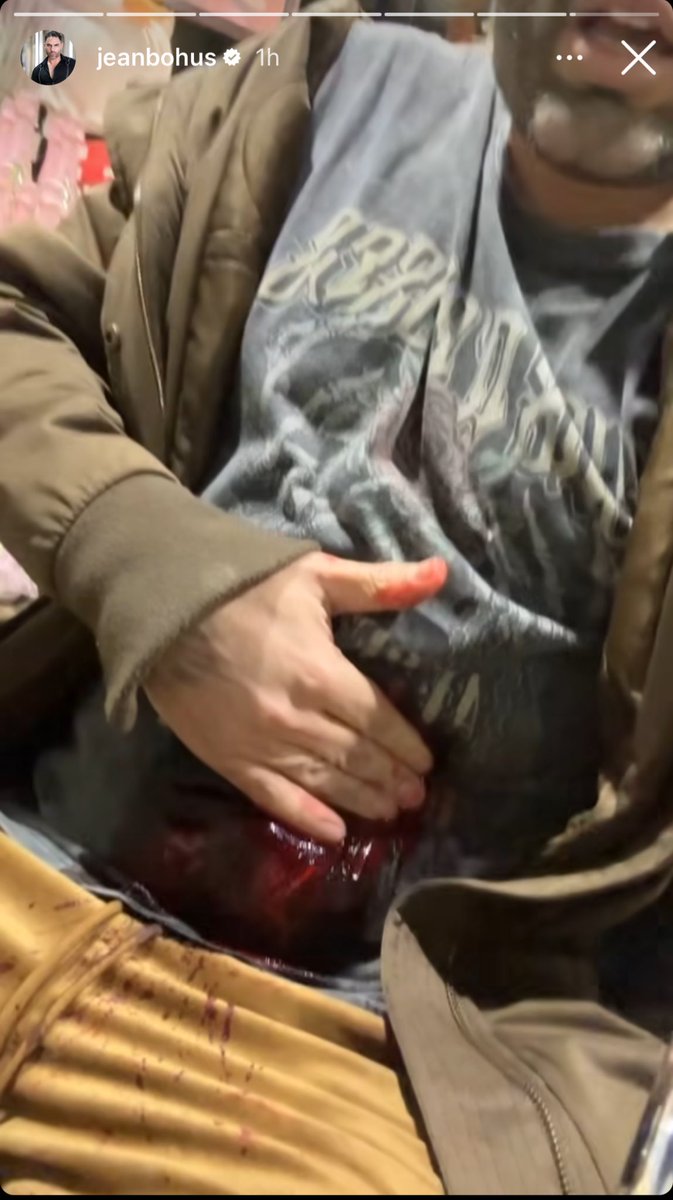 solo_gemma's tweet photo. Jean Bohus recibió un disparo en la pierna, una puñalada en el estómago y le roban su auto. Terrible‼️ 
Recuerden q hoy la puta @MaiteOrsini no quiso votar por la Ley RUF para dar seguridad @Carabdechile q se tienen q enfrentar a esos asesinos TODOS LOS DÍAS!! #ComunistasAsesinos https://t.co/27u5SBLeoS