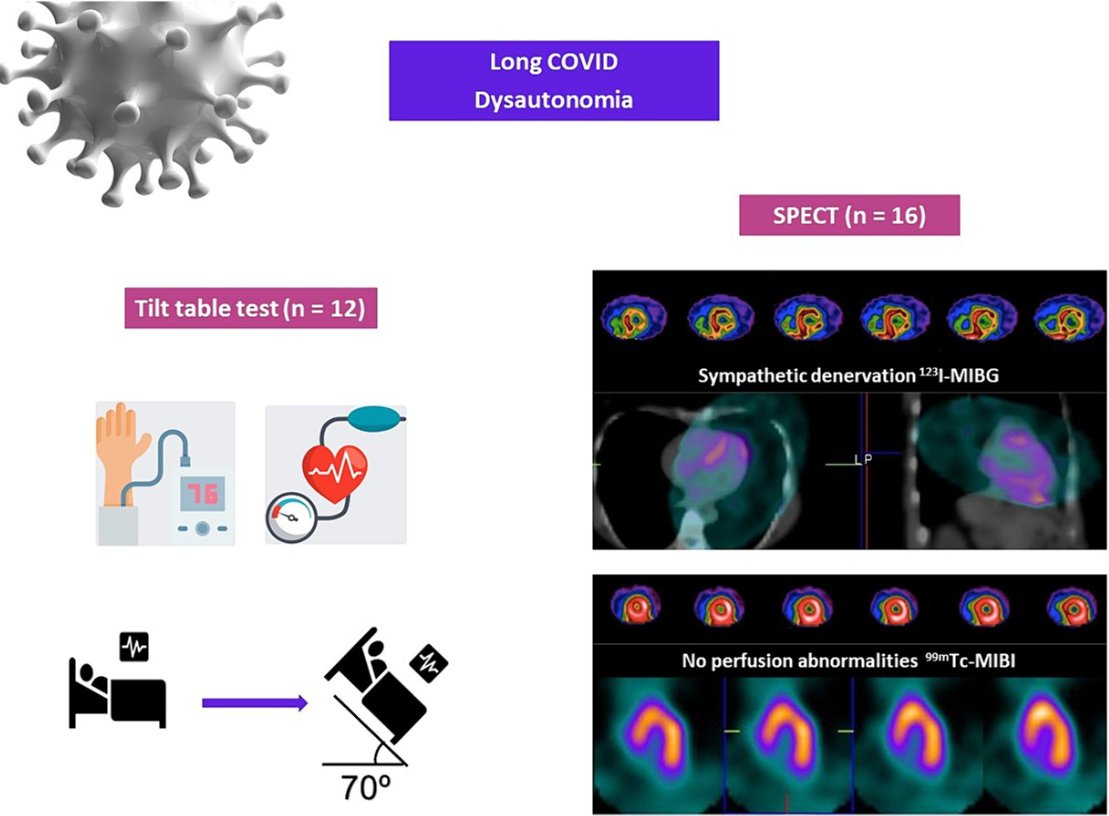 Value of 123I-MIBG SPECT for the assessment of dysautonomia in patients with long COVID ❗Interesting small investigational study from Brazil on MIBG-SPECT as a diagnostic tool. ➡️'Long coronavirus disease (COVID) can affect the autonomic nervous system (ANS), resulting in…