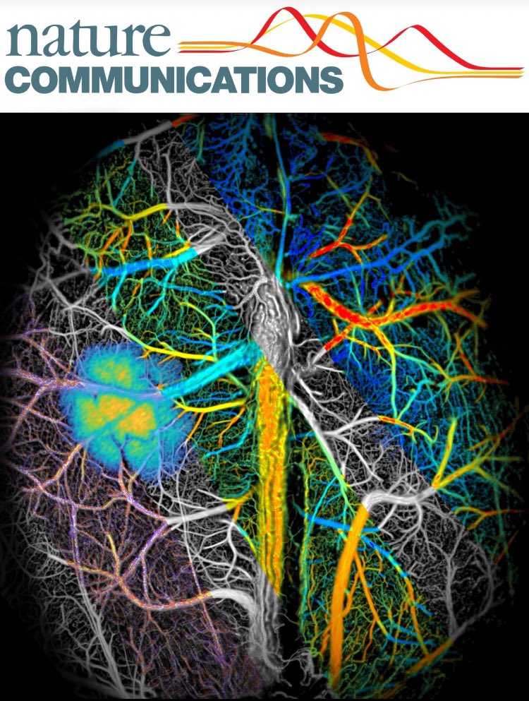 We present a major leap forward in large-scale transcranial fluorescence imaging of brain dynamics ! Kudos to Zhenyue Chen, Quanyu Zhou, Chaim Glück and the whole team 🎊 Another terrific collaboration with @mohamad_elamki, @SuseWegener nature.com/articles/s4146…