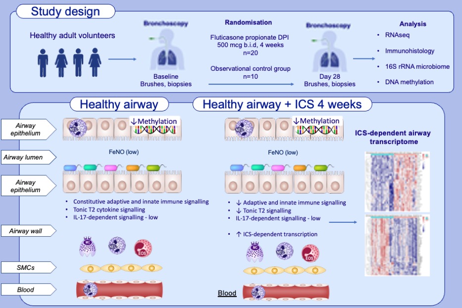HinksLab's tweet image. Out today: an unexpected discovery from our Leicester/Oxford healthy volunteer bronchoscopy study. In health there is constitutive type 2 signalling within the airway mucosa, which is exquisitely sensitive to ICS. Read it now in doi.org/10.1111/all.16…