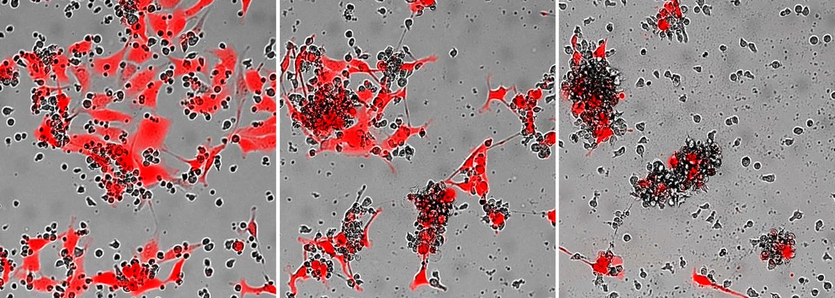 institut_curie's tweet photo. 🚀 Coup d’envoi de #CellAction à l’@Institut_Curie, plateforme inédite en France pour accélérer l’innovation et l’accès aux thérapies cellulaires et géniques, notamment les cellules CAR-T.
➡️ Pour en savoir plus : https://t.co/3TrcmOEH88
#PSCC #CARTcell
1/2 https://t.co/rou8dz1g9y