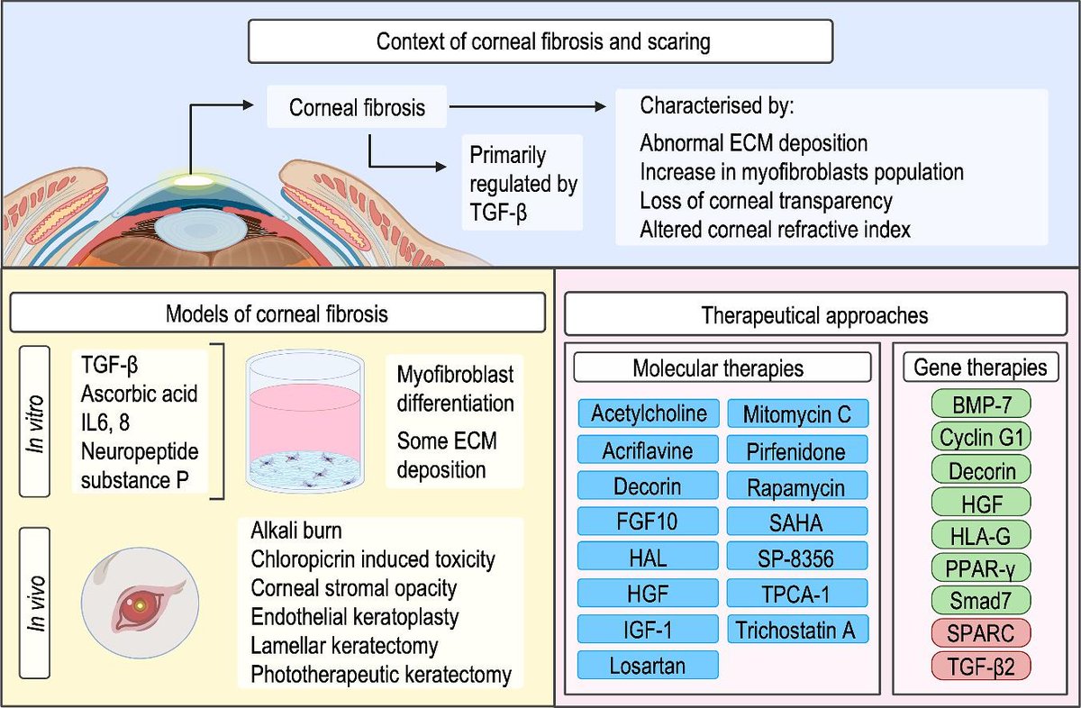 ADDR 50 days' free access: Corneal fibrosis: From in vitro models to current and upcoming drug and gene medicines. By Dimitrios I. Zeugolis & coworkers @ucddublin @UKICRS @REMODEL_IE #GeneMedicine #CornealFibrosis doi.org/10.1016/j.addr…