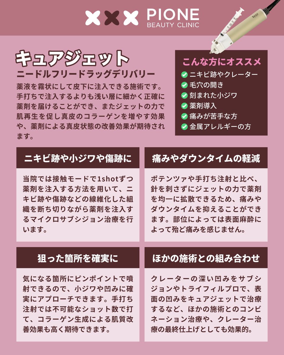 針を使わずに薬剤を皮膚内に注入できる
キュアジェットがついに予約開始！

手打ち注射の何倍も細かくそして浅めの層に均一に薬剤を注入でき、ジェットの力で肌再生を促し真皮のコラーゲンを増やす効果がある最新マイクロサブシジョン治療です。

クレーター治療の仕上げや、注射の痛みが苦手な方に☘️