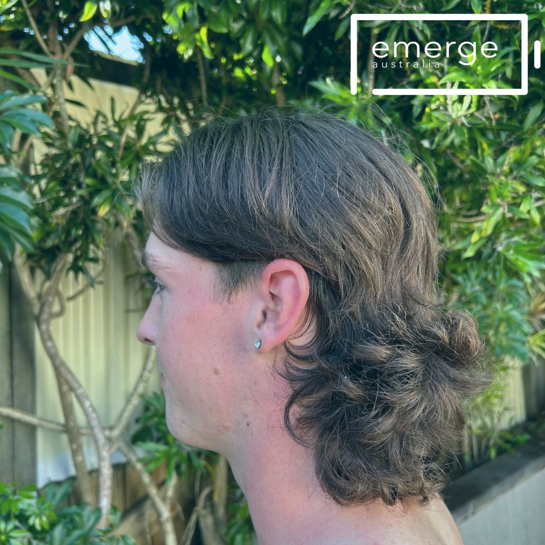 Support Tommy's head shave for ME/CFS Awareness Week! Help raise funds for ME/CFS research with Emerge Australia & make a difference. Join us HERE vist.ly/34bvq