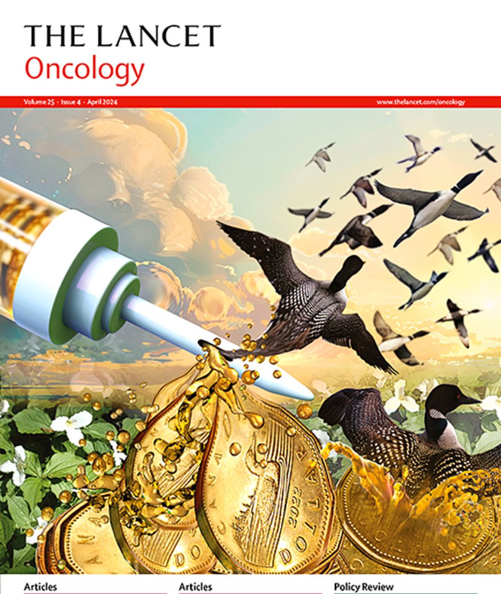 It's @TheLancetOncol day for Rad Onc GU! Our consensus on SBRT for Oligomets RCC is finally out! Thanks to all the participants! 🔥🔥🔥🌟🌟🌟
Delphi consensus on stereotactic ablative radiotherapy for oligometast... sciencedirect.com/science/articl…