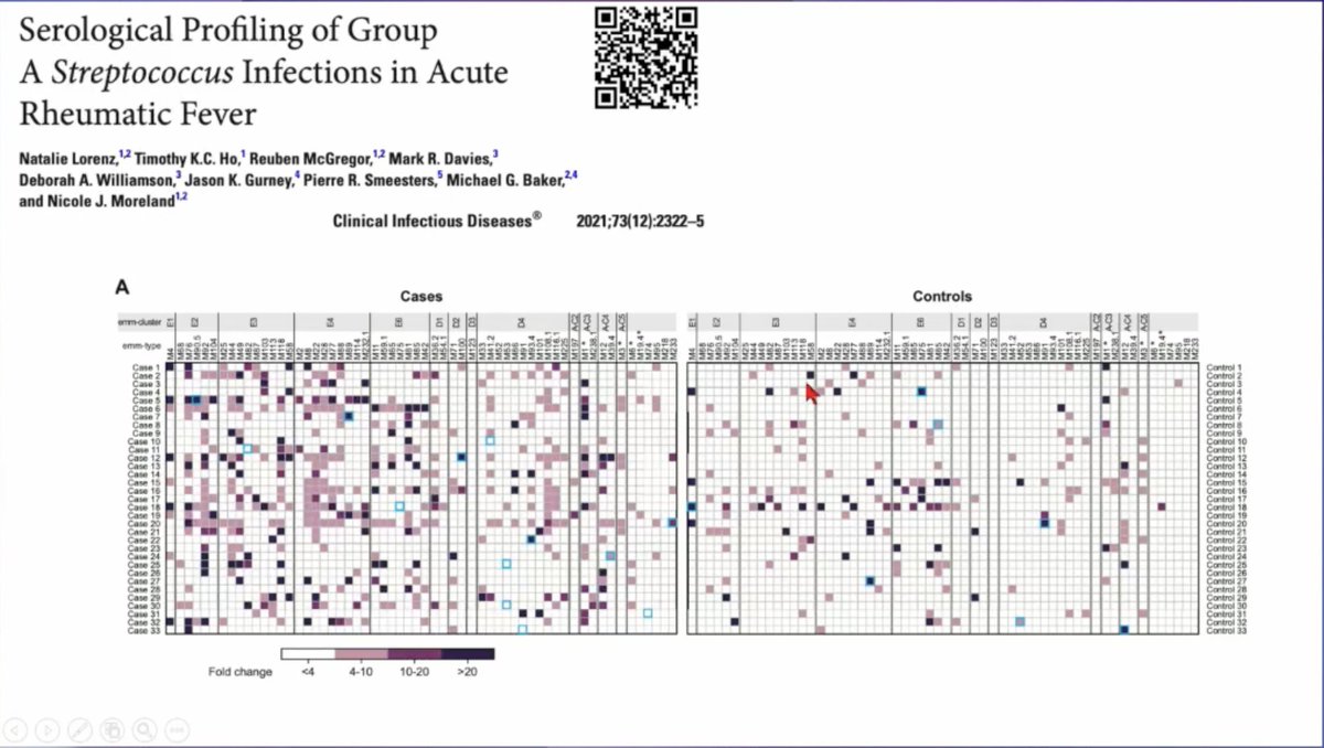 @mrcunitgambia @edwinarmitage @AlexJKeeley @alice_ahalliday @DoctorRach13 @anu_goenka @GCrombrugghe #ECCMID2024 Lifetime exposure to a diverse range of #StrepA types is associated with Acute Rheumatic Fever. Therefore ? lower Human Development Index = wider range of circulating emm-types = increased risk of ARF & RhD