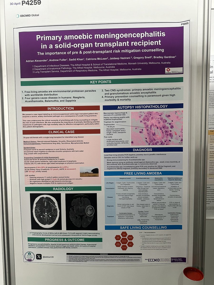 Poster is up! P4259, come learn about amoebic meningoencephalitis and safe living counselling today! @ESCMID #ESCMIDGlobal2024 #ESCMIDGlobal #ECCMID2024