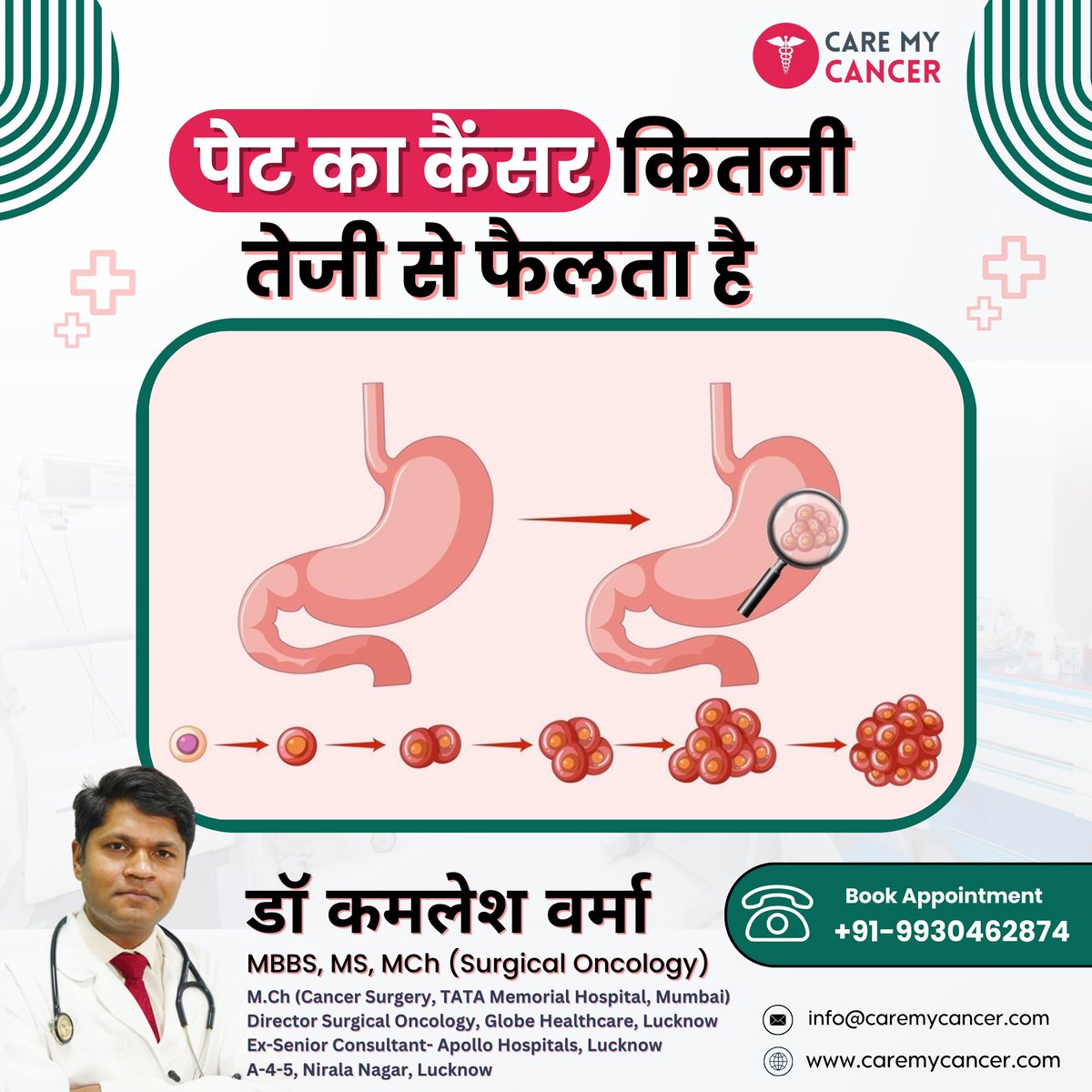 Did you know that stomach cancer can spread swiftly through the body? Learn more about its rapid progression from Dr. Kamlesh Verma. Stay informed, stay healthy! 

#CancerAwareness #HealthTip #StomachCancer #CancerTreatment #DrKamleshVerma #Oncologist #Lucknow