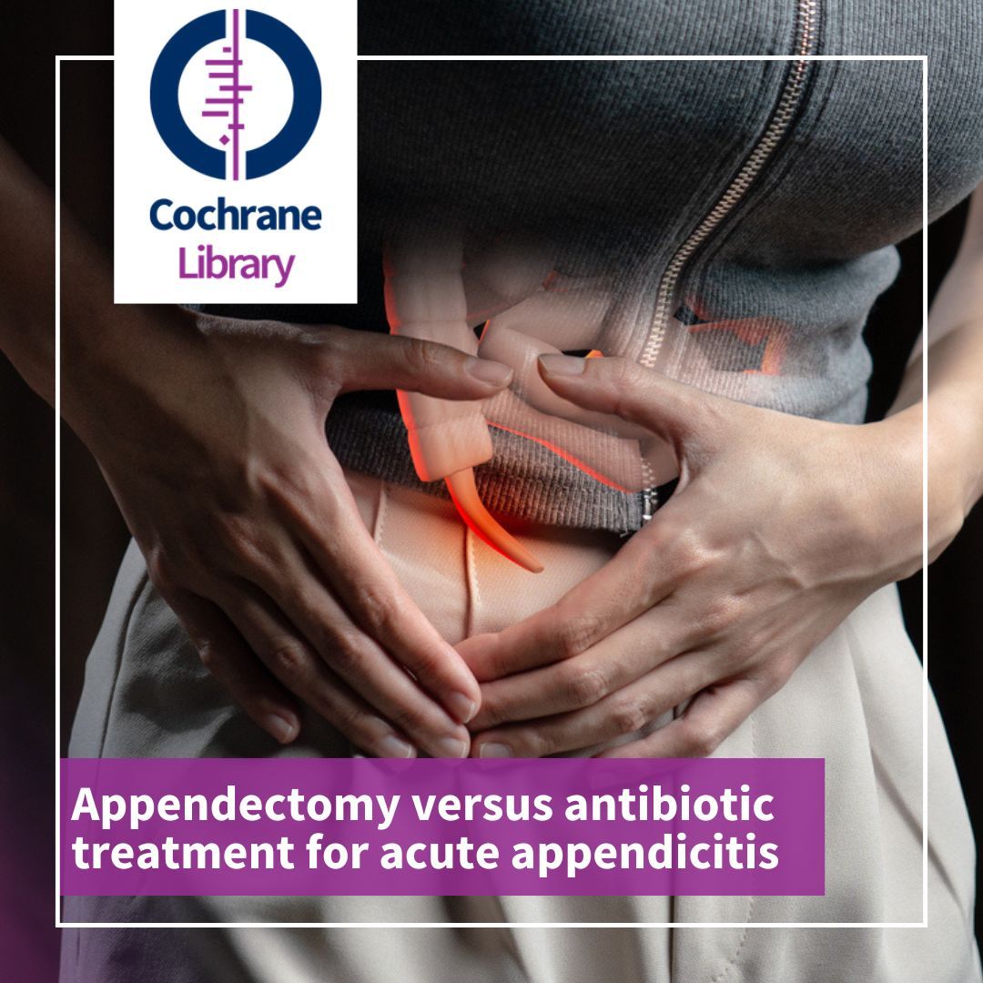 #appendicitis treatment...💊 Medicine that kills bacteria? 🏥 Or surgery? 🤔 📚 🔍 We looked at the evidence from 13 studies with 3358 people Read the #SystematicReview and #PlainLanguage summary in the #CochraneLibrary buff.ly/3xWDFxb