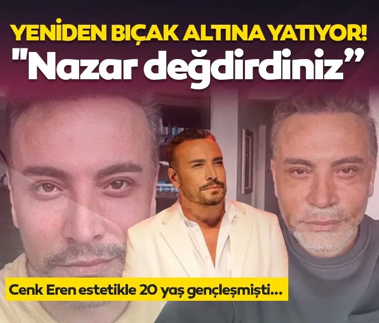 Cenk Eren, derin yüz germe, çene ucuna ve bütün boyun bölgesine germe işlemi yaptırmış. Estetik modasına uyan Cenk Eren adeta 20 yaş gençleşmişti. 58 yaşındaki Eren, estetik sonrası 'Nazar değdirdiniz' diyerek yeniden bıçak altına yatacağını duyurdu. sabah.im/41831n_smt