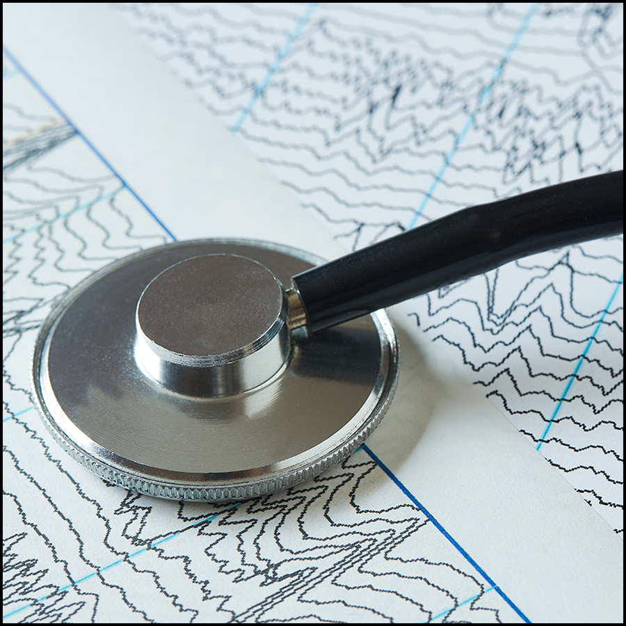 The hypothesis that spatiotemporal complexity may serve as a state-related, but not drug-related, EEG indicator of an unconscious state was tested in patients in whom #anesthesia was induced with propofol or esketamine. Read more in @_Anesthesiology: ow.ly/5YMG50RxVTV